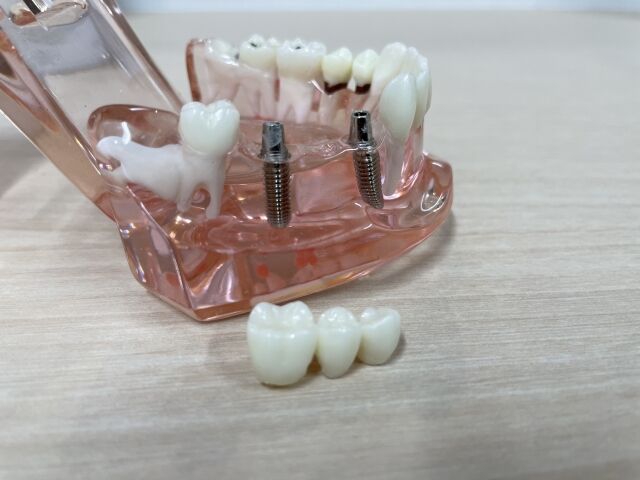 ブログ
