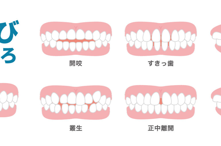 ブログ}